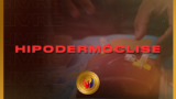 Hipodermóclise